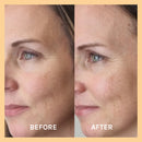 Miracle Vitamin C Mask