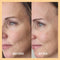 Miracle Vitamin C Mask